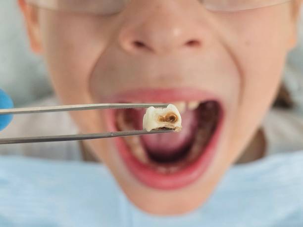 Best Dentist for Dental Trauma  in Rosewood Heights, IL